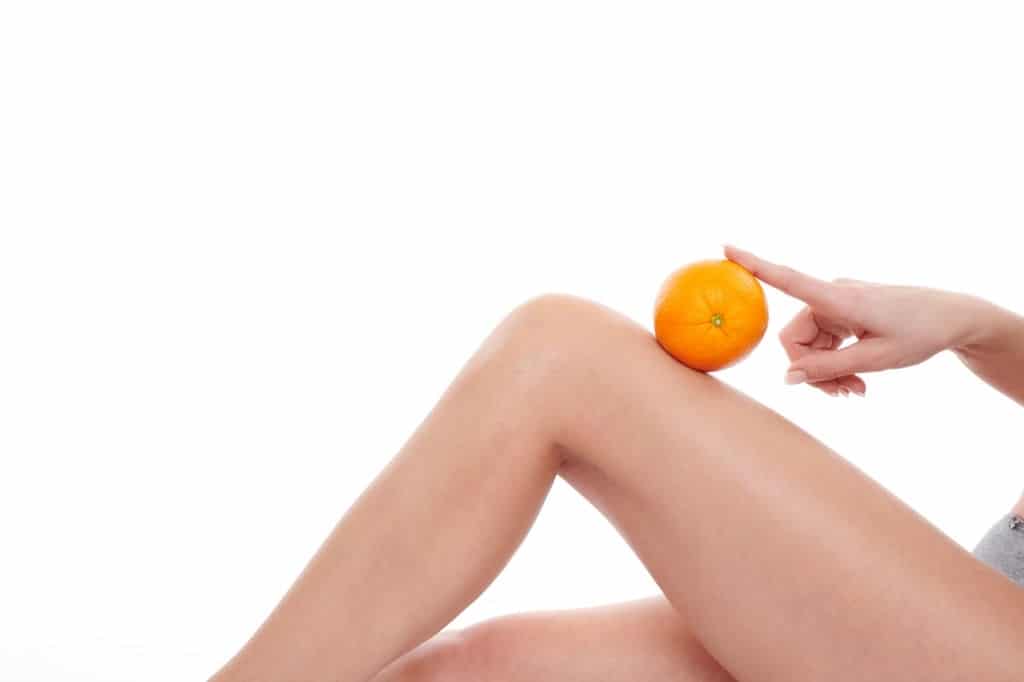 La cellulite, aspetto a ''buccia d'arancia''.